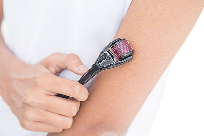 Close up of woman’s hand using derma roller on islolated white background, derma roller in focus. Roller ,microneedle, mesotherapy, rejuvenating, beautification, skin care. - Image